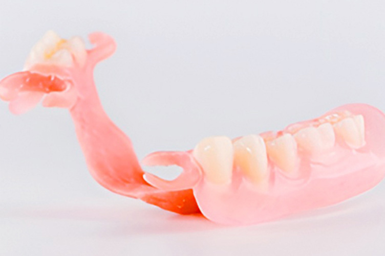 ノンクラスプデンチャー