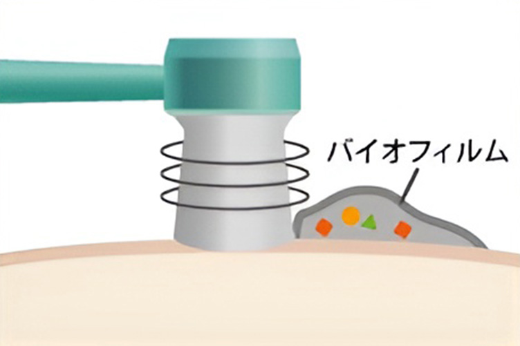バイオフィルム