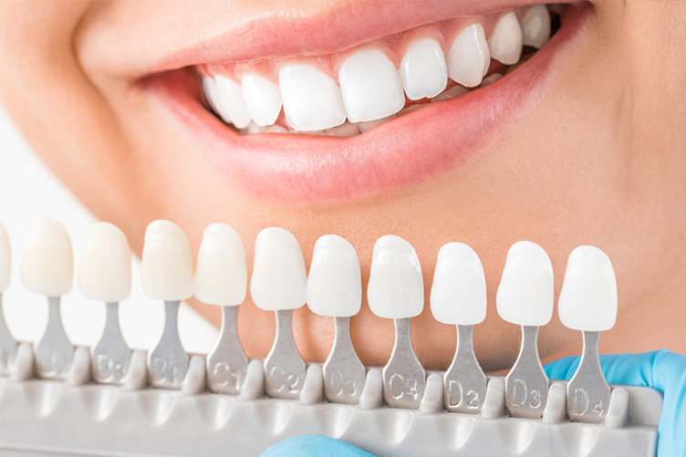 むし歯や歯周病になりにくい