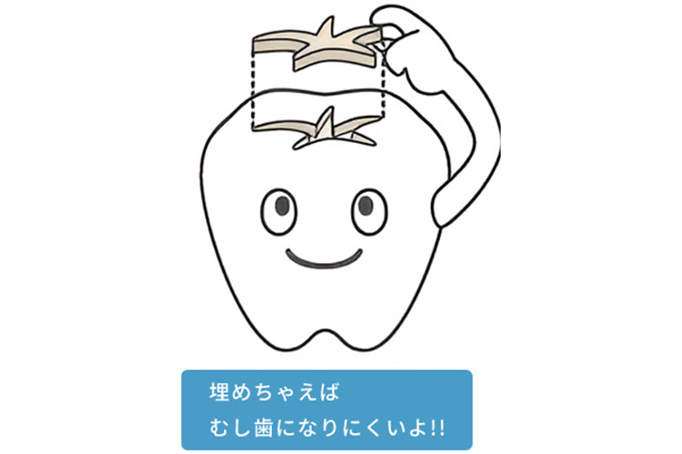 定期管理が大切