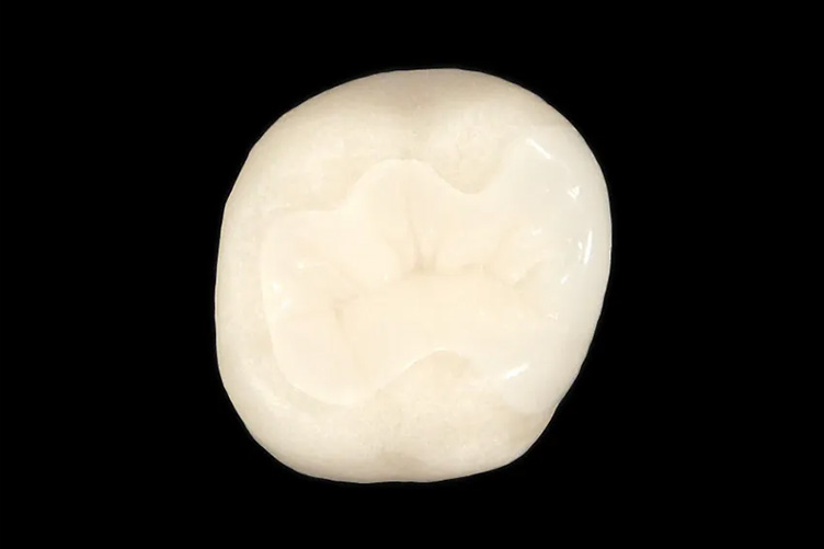 ハイブリッドセラミック