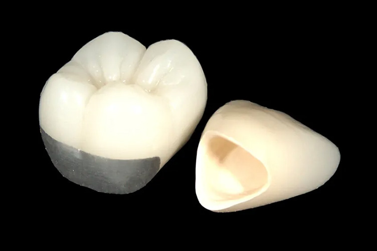 ハイブリッドセラミック